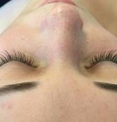 Medium set of extensions